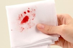 Recetas efectivas y formas de eliminar la sangre de la ropa en casa.