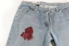 Métodos y recetas sobre cómo eliminar eficazmente la sangre en los jeans